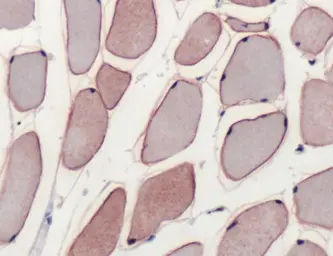 Anti-Dysferlin antibody (Ready-to-use) used in IHC (Paraffin sections) (IHC-P). GTX15109